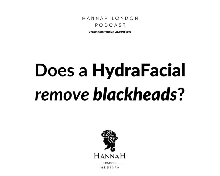 Does a HydraFacial remove blackheads?